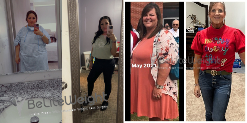 Lisa H - 3 Year After Gastric Sleeve